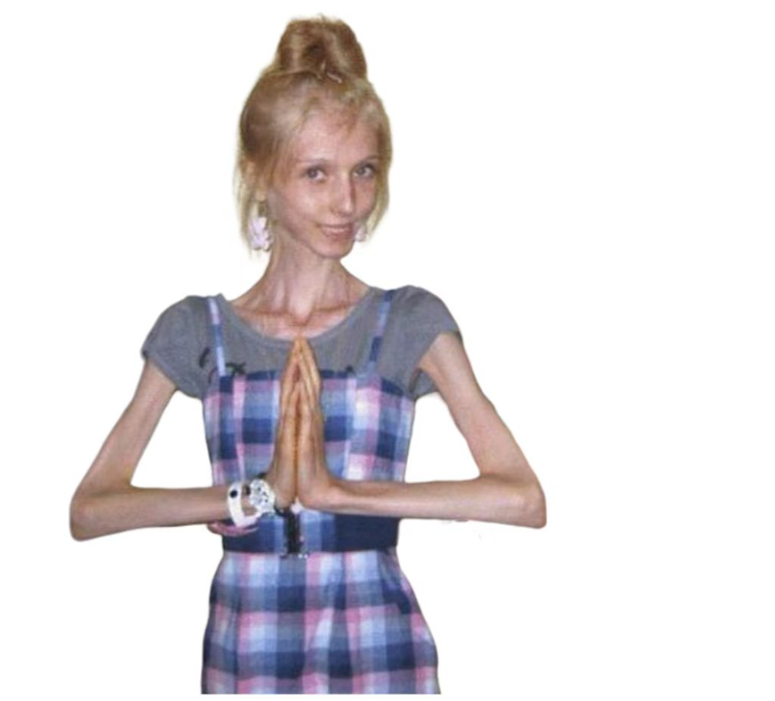 骨感美真的很美吗