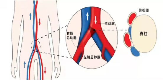 髂静脉股静脉解剖图图片