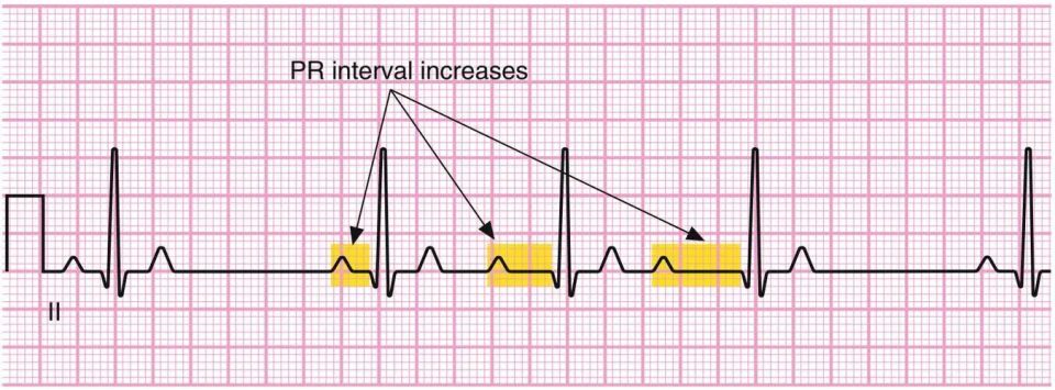 心电图机怎么维护别等“系统报错”才想起维护：一份写给当代打工人的心脏运维指南_https://www.jmylbn.com_新闻资讯_第8张
