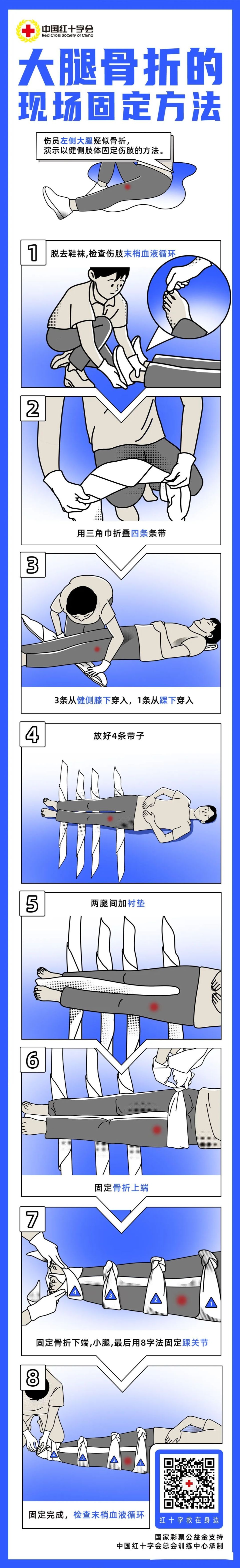 大腿骨折的现场固定方法