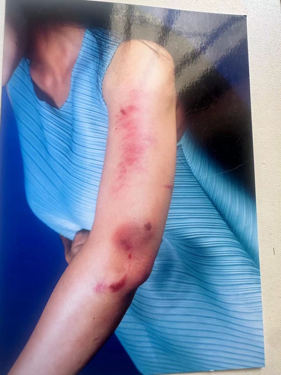 云南一原副县长婚内出轨殴打女方 警方:基本属实,已行拘