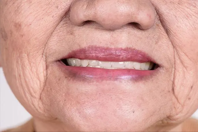 大部分寿命长的人,嘴唇一般都会有这3个特征