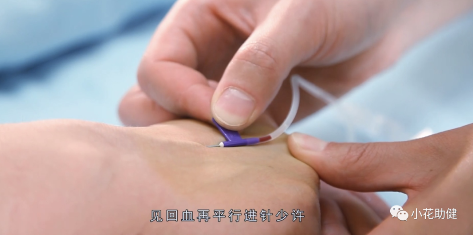 6,穿刺时,以左手拇指绷紧静脉下端皮肤,使其固定,右手持注射器,针头