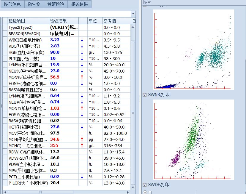 血细胞分析散点图解读图片