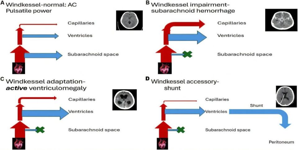 medtronic起博器怎么样追问daily ｜ Cell：为什么脸上受伤不易留疤？神经元并非只靠糖分运作；脑积水实为脉动能量吸收障碍所致_https://www.jmylbn.com_新闻资讯_第6张