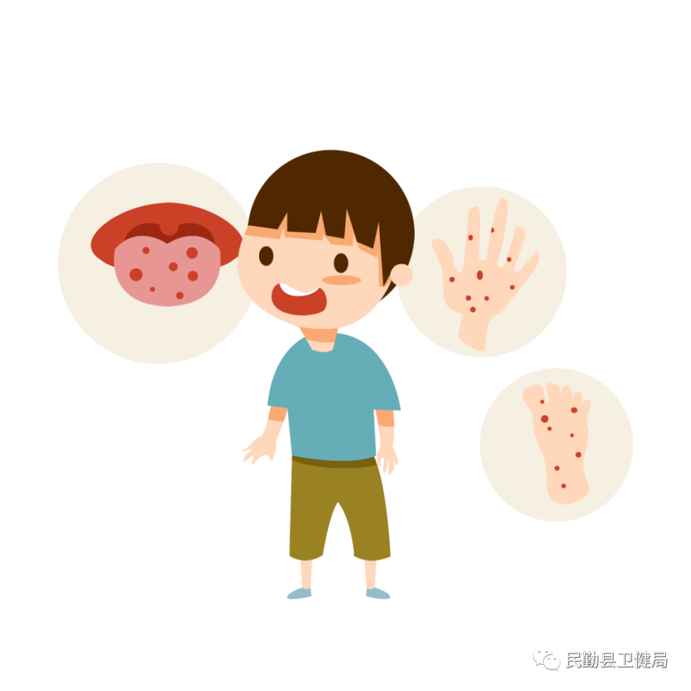 民勤县卫生健康局夏季常见传染病防控温馨提示