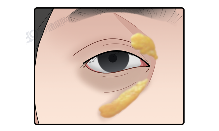 ͼƬ