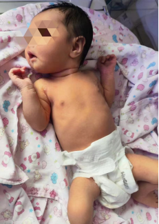 光疗时为什么黑眼罩【科普作品推荐】什么样的“光”能退黄_https://www.jmylbn.com_新闻资讯_第2张