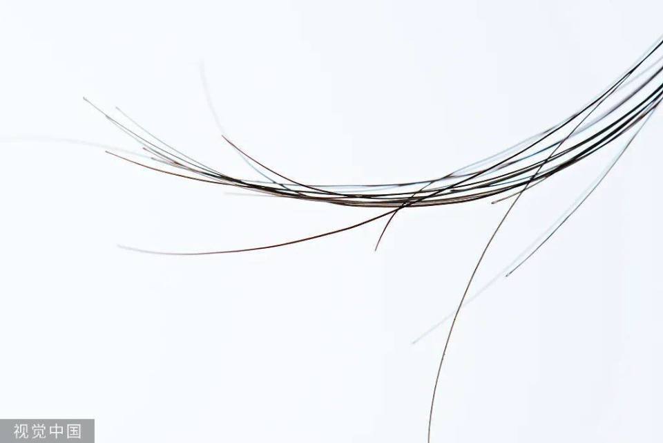 人体皮肤上包括头发在内的所有毛发,虽然长短,粗细,颜色,形态各不相同