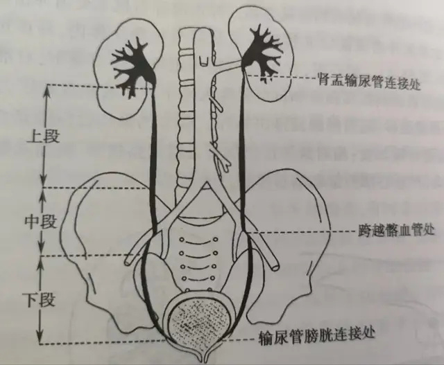 输尿管末端图片