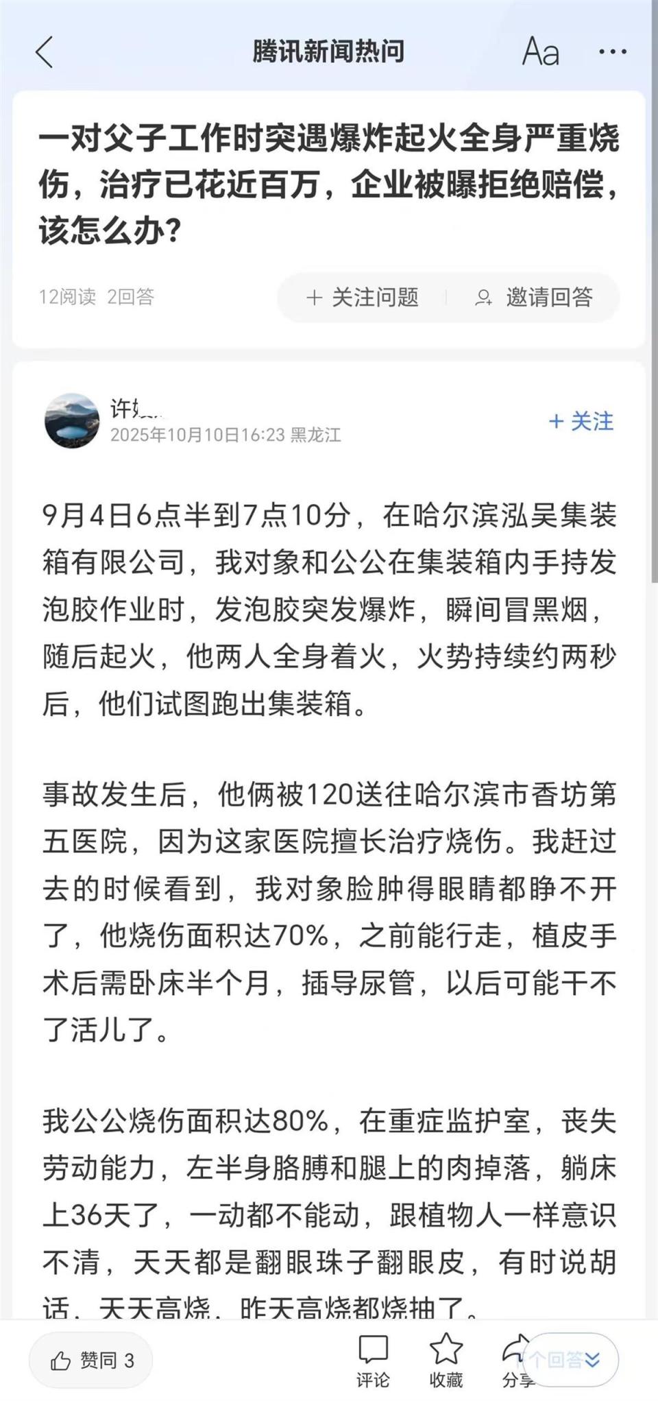 女子称丈夫和公公持发泡胶作业遇爆炸严重烧伤，当老板的表哥拒垫付后续治疗费还不接电话，应急部门介入调查-腾讯新闻