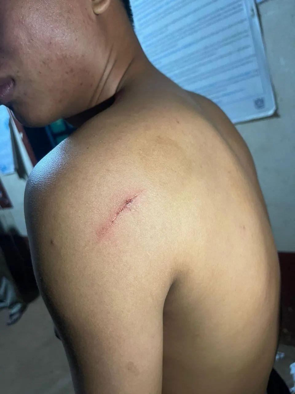 柬一对新人的结婚日,一伙人冲进屋里将新郎及伴郎砍伤