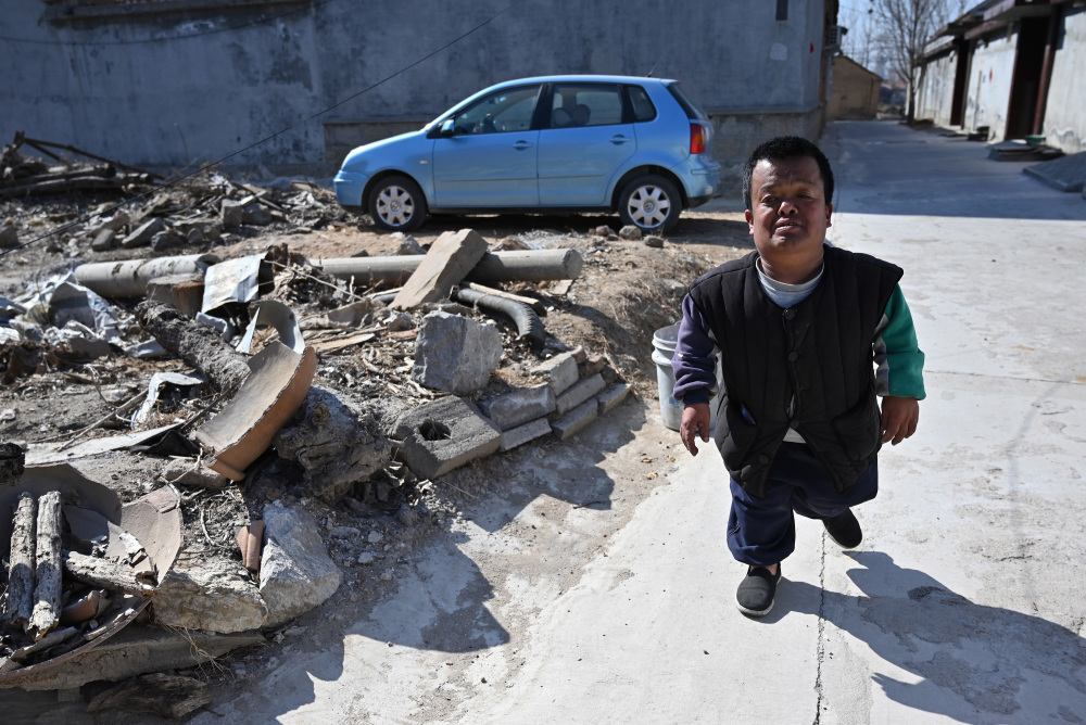 张世路是山东日照莒县阎庄街道张家当门村人,患有先天性侏儒症,身高仅