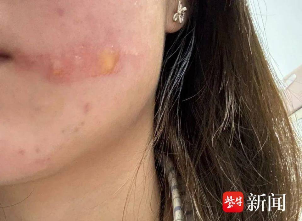 当心!这种虫子会放出100℃"毒屁""烫伤"你