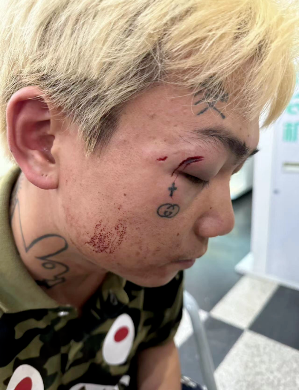 哪怕被打的鼻青脸肿,kenrobb在粉丝群依然嚣张,不过哪怕表面装的若无