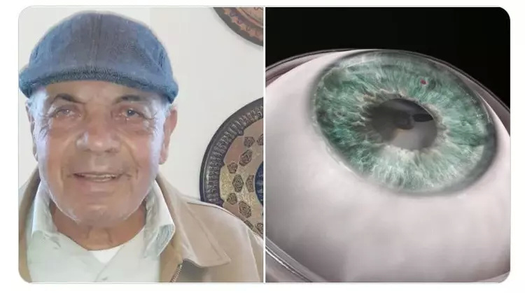 (以色列78岁盲人贾马尔99弗拉尼因人工角膜重见光明/图源:twitter)