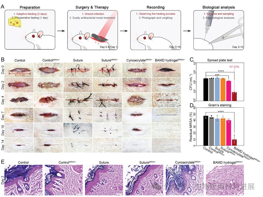 医用抗菌水凝胶怎么用《AFM》湖北大学吴水林／河工大刘想梅： 多模式消毒功能的强粘附Janus水凝胶，用于多重耐药金葡球菌感染的开放性伤口快速修复_https://www.jmylbn.com_新闻资讯_第8张