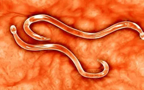 藏满寄生虫的水果,开水都杀不死,别再往嘴里送了!