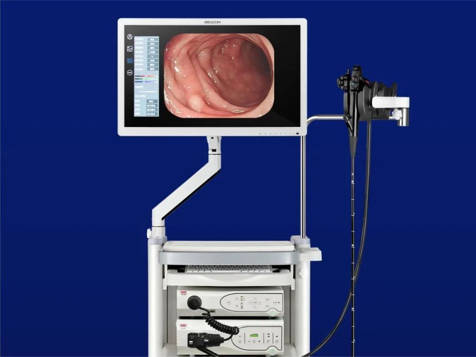 cmef:内窥镜新品抢先看_腾讯新闻