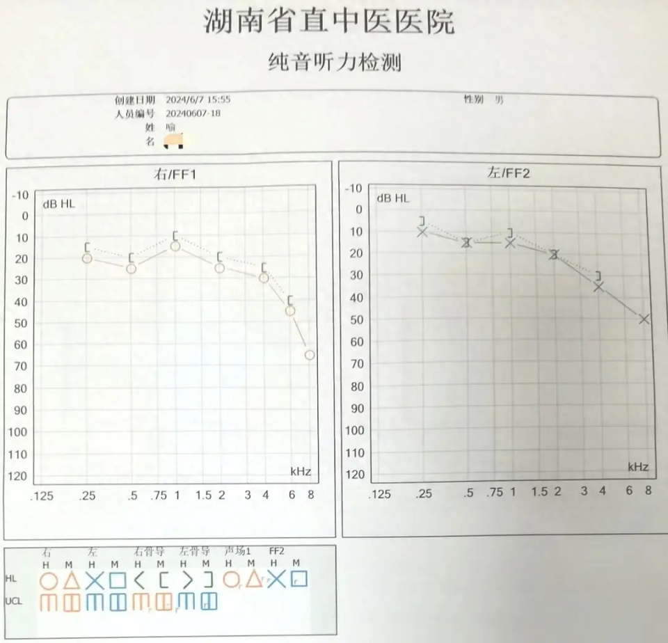 耳鸣,耳聋?疗效欠佳?来试试"肖三针"医生的浮针疗法