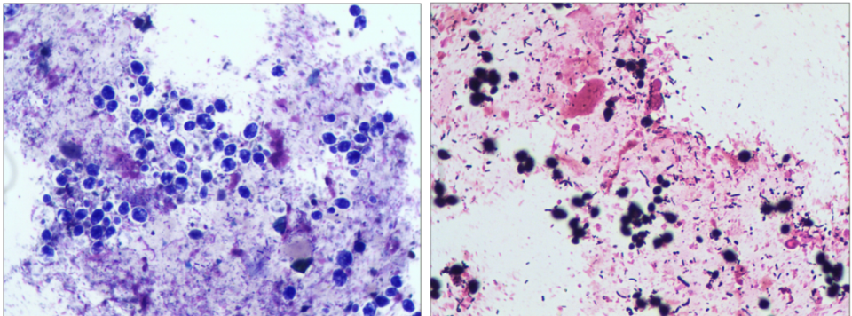 粪便常规仪器怎么用粪便中的繁星点点_https://www.jmylbn.com_新闻资讯_第3张