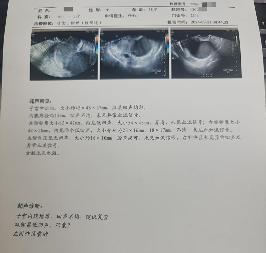 初步诊断:双侧卵巢子宫内膜异位囊肿,左侧附件区囊肿体格检查:腹平软