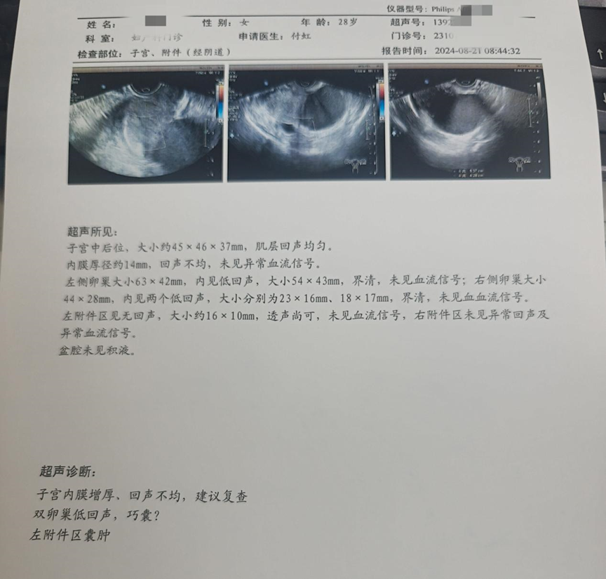 巧囊超声图片