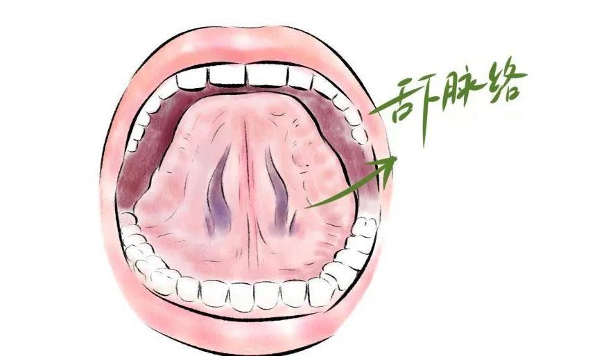 如何拍出一张标准的舌象照片？互联网诊疗必备技能_腾讯新闻