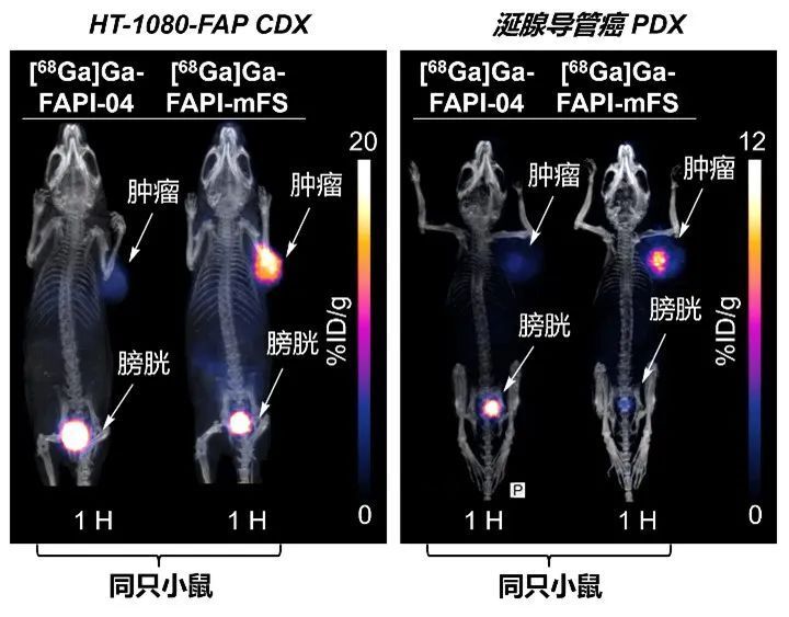 比其他方法(包括传统fapi-pet/ct)识别出了更多的甲状腺髓样癌病灶,并