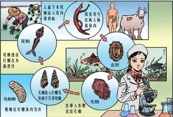 血吸虫病(schistosomiasis)是由血吸虫寄生于人体所致的疾病,是世界