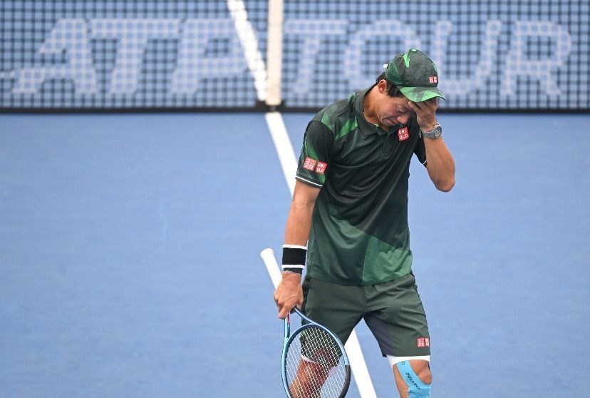 锦织圭将错过2024澳网,将以参加3月份的大师赛为目标