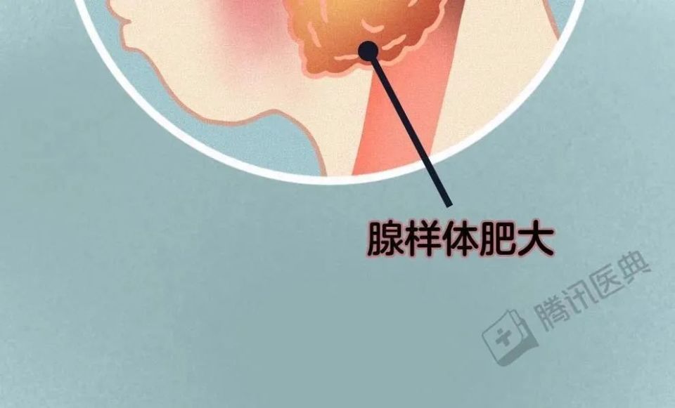 这种现象可能是猝死