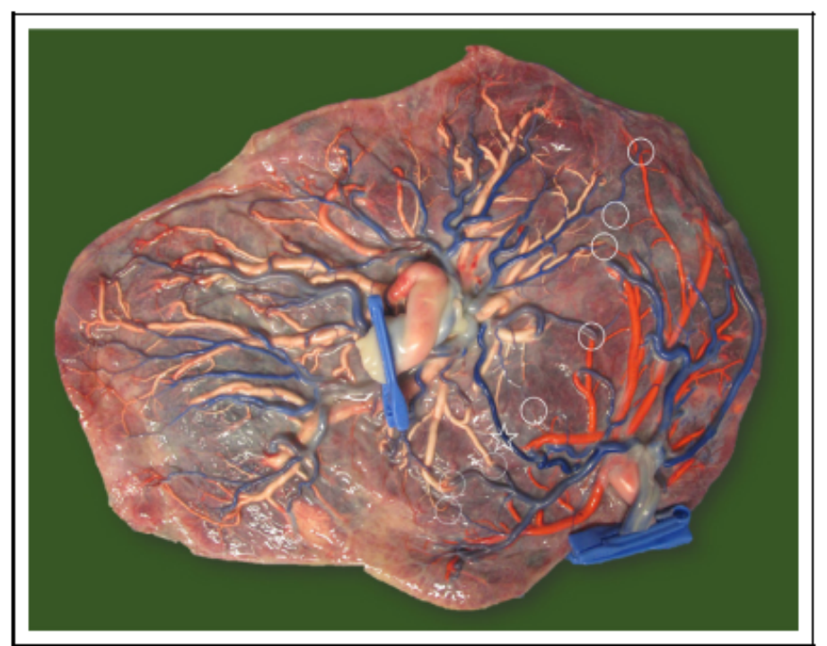 双胎分娩孕周更新单绒3637周单羊33周2023sogc最新指南