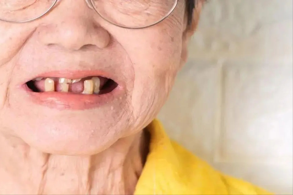 积极的情绪状态可以促进血液循环,进而影响到嘴唇的色泽和健康状况