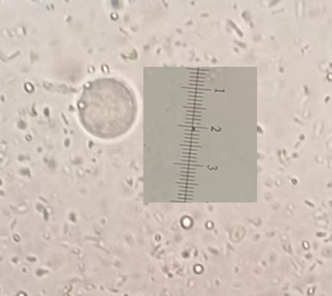 迪斯帕内阿米巴