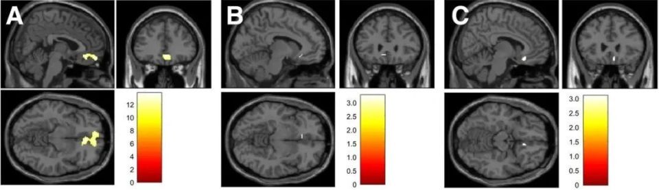 心电图机器怎么看追问weekly ｜ 过去一周，脑科学领域有哪些新发现？_https://www.jmylbn.com_新闻资讯_第17张