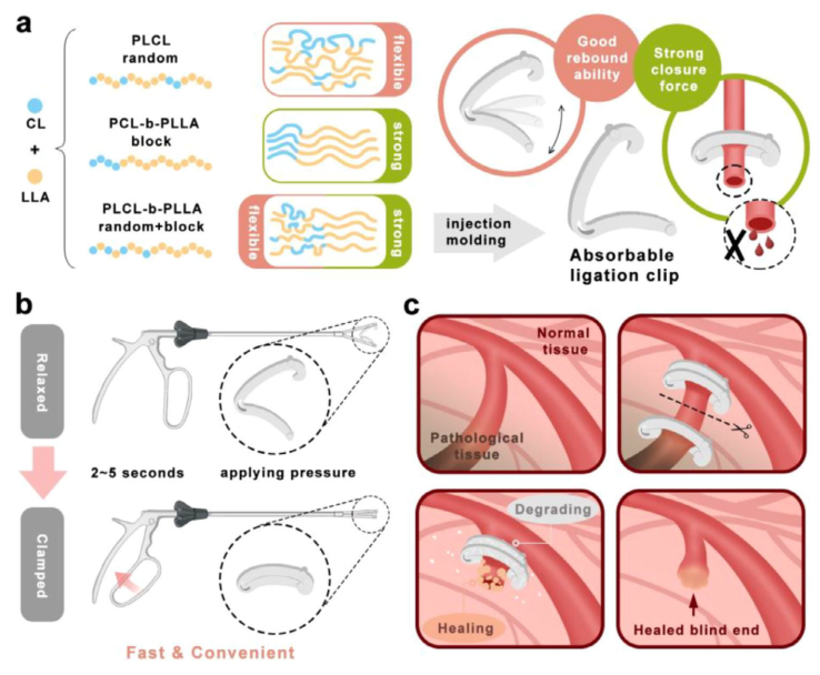 什么是可吸收夹四川大学何斌、成都大学高文霞AM：新型可降解共聚物为高性能组织结扎夹带来革新_https://www.jmylbn.com_新闻资讯_第2张