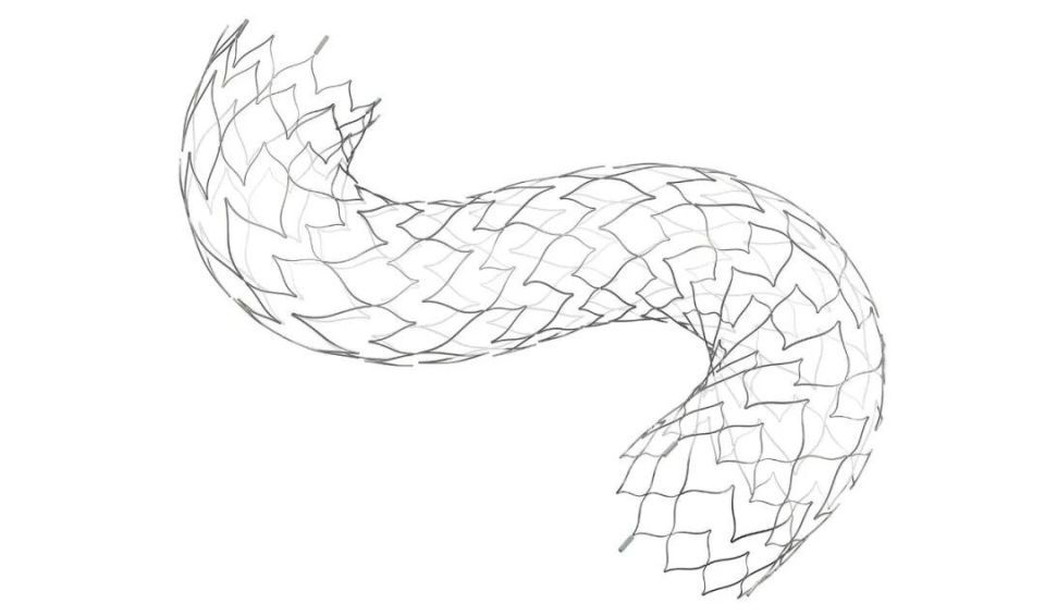 外科缝合包都有哪些以缝合方式实现PFO治疗，聚芯医疗为3亿卵圆孔未闭患者心脏补“洞”_https://www.jmylbn.com_新闻资讯_第5张