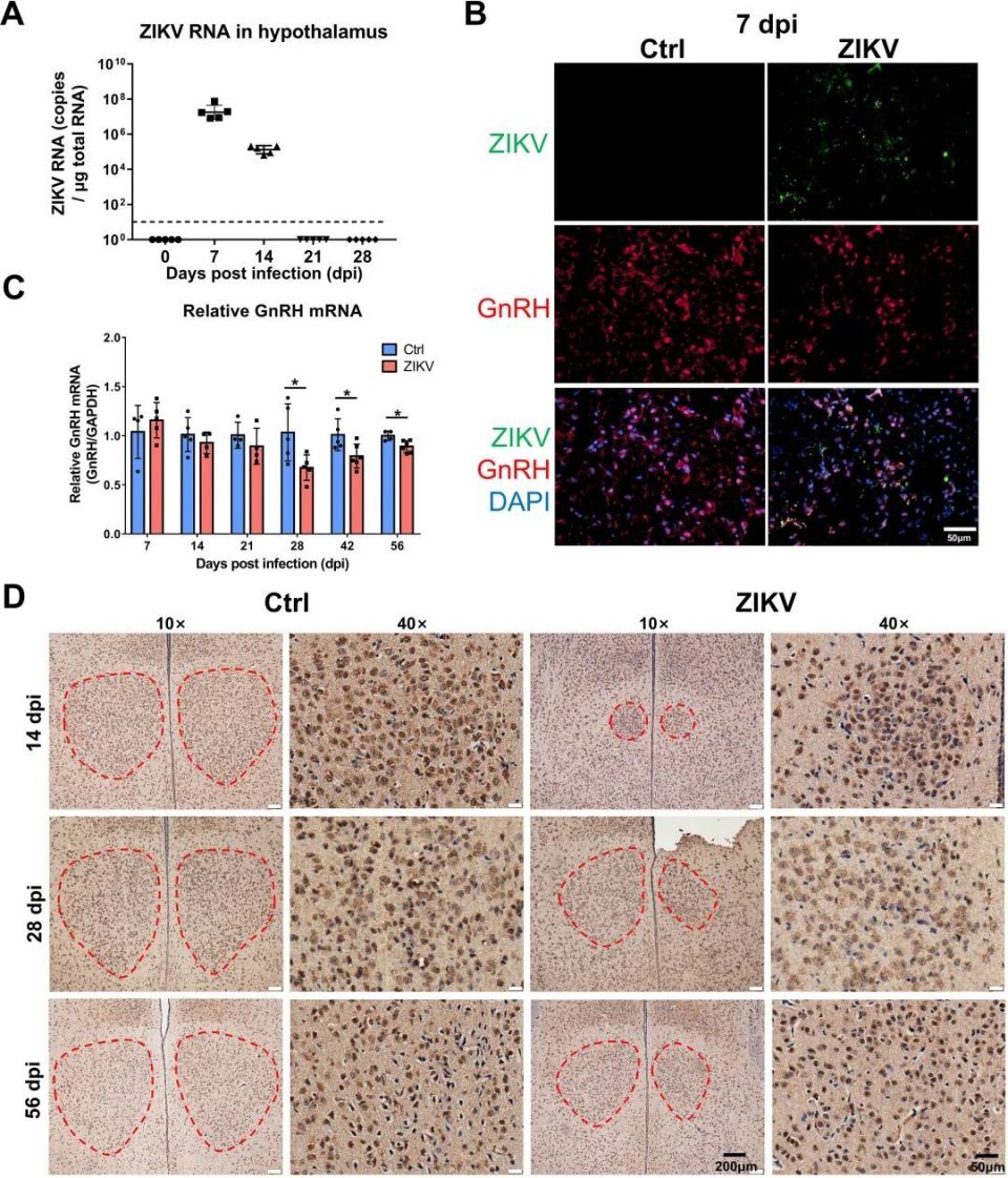 jvi|zikv感染导致下丘脑-垂体-性腺轴激素缺乏和生育能力下降