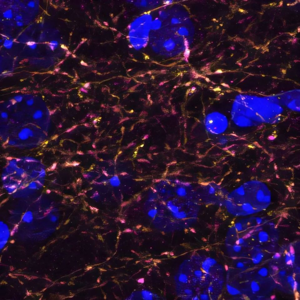 以色列医疗设备有哪些追问weekly ｜ 过去一周，脑科学领域有哪些新发现？Vol.63_https://www.jmylbn.com_新闻资讯_第4张