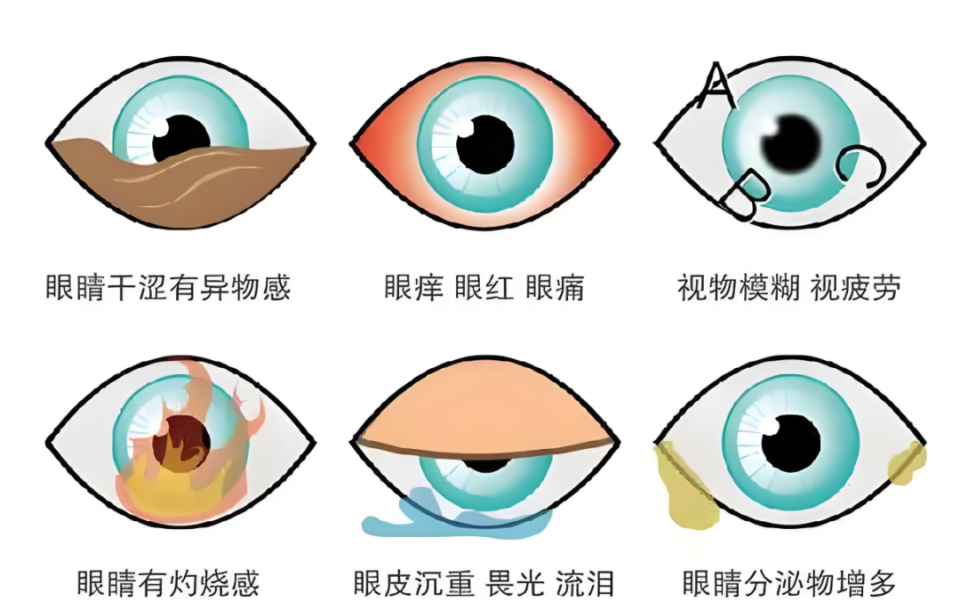 过年期间用眼,警惕干眼症悄然来袭!这份"健康锦囊"快收藏转发