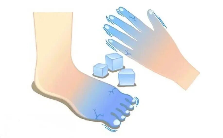 为什么大部分女生手脚冰凉，如何改善？_腾讯新闻