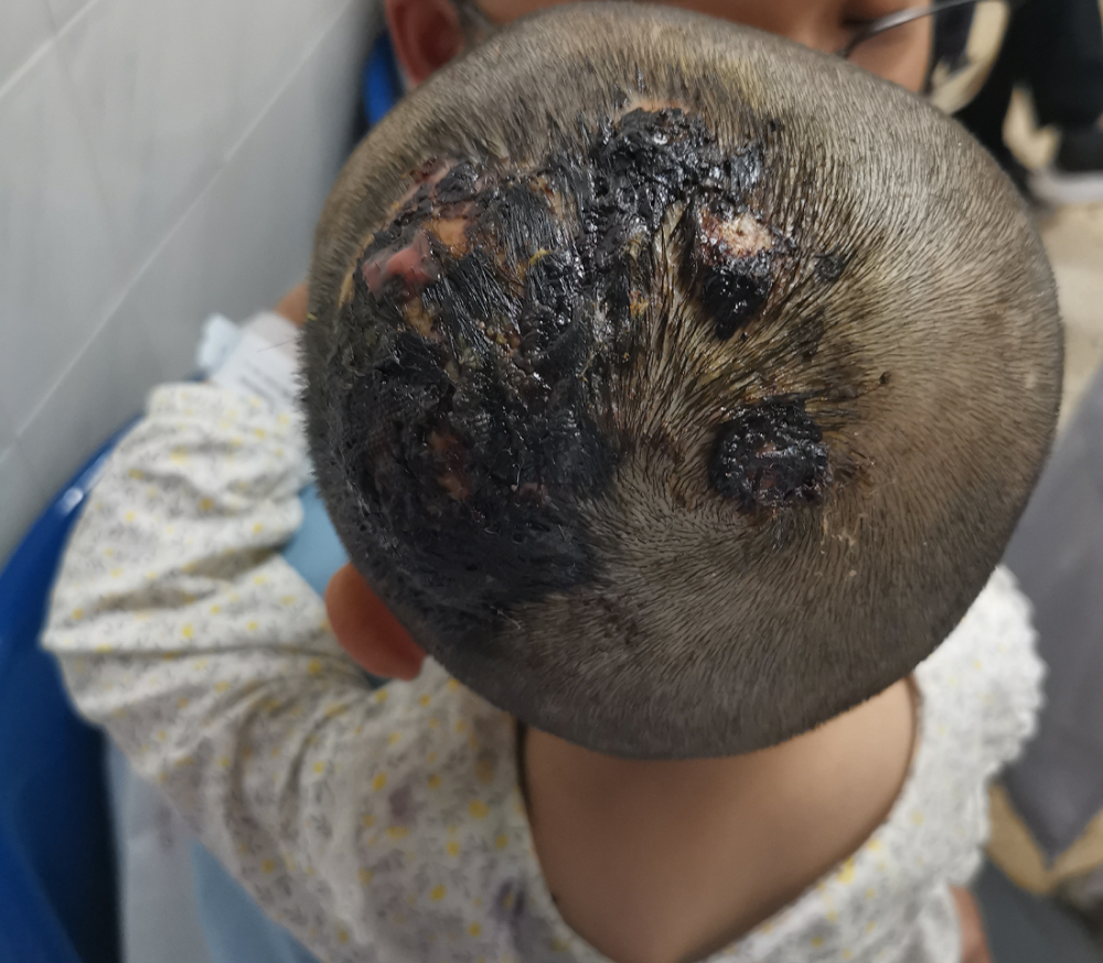 3岁女童头上长出大蘑菇罪魁祸首竟是家中养的它