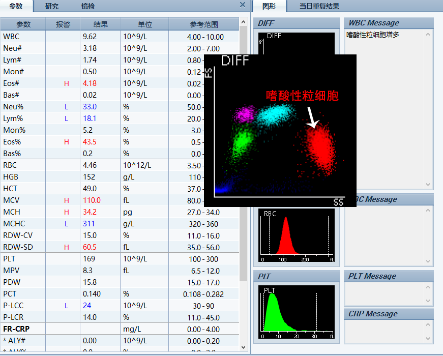 血常规直方图与散点图图片