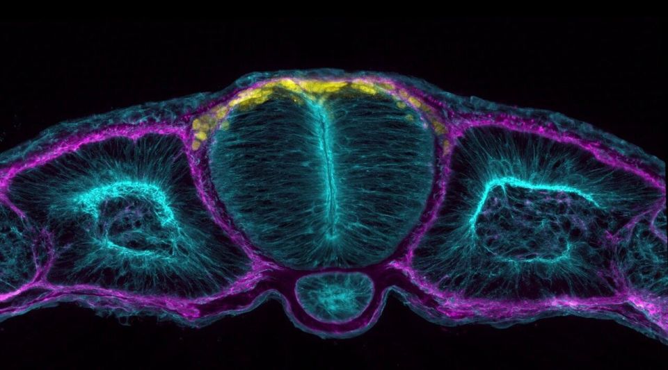 medtronic起博器怎么样追问daily ｜ Cell：为什么脸上受伤不易留疤？神经元并非只靠糖分运作；脑积水实为脉动能量吸收障碍所致_https://www.jmylbn.com_新闻资讯_第2张