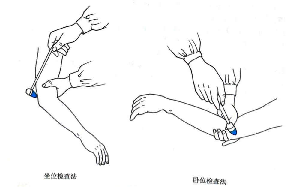 检查方法:患者前臂置于旋内及半屈位置,检查者以手握住前臂,并以叩诊
