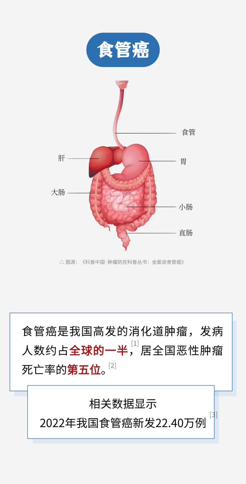 全球一半的食管癌在中国!这3种饮食习惯是元凶,尽早改!