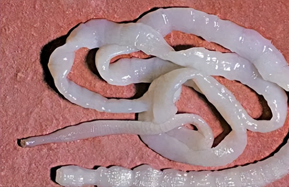 女子常吃牛肉体内排出4米长绦虫,哪类人体内容易有虫?怎样预防?