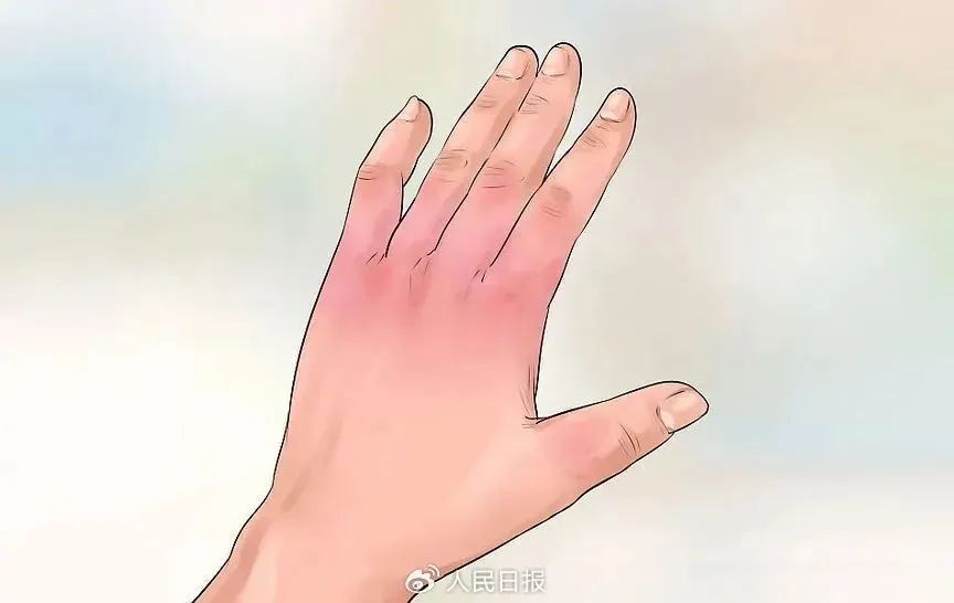 641
