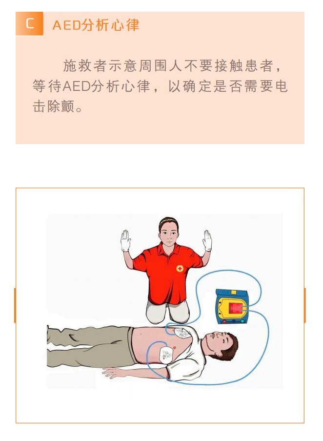 图解心肺复苏操作流程教你把握黄金四分钟